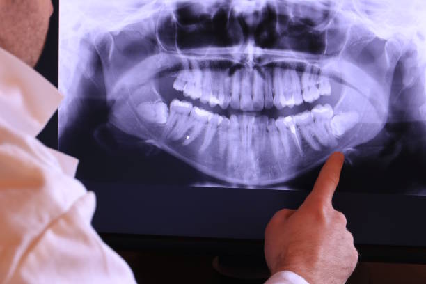 Best Walk-In Emergency Dentist in Logan Elm Village, OH
