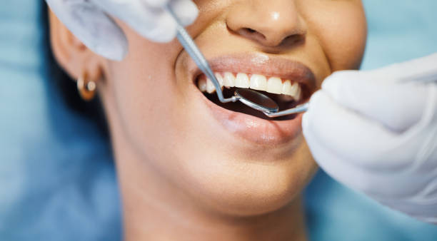Best Emergency Tooth Extraction in Logan Elm Village, OH